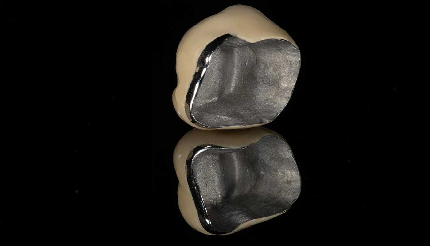 メタルボンドクラウン